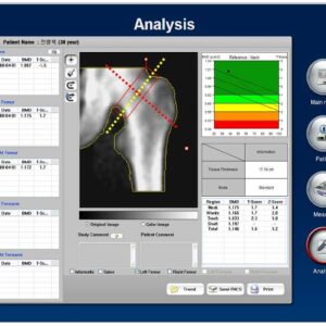 Osteodensitometru Econet Inus D