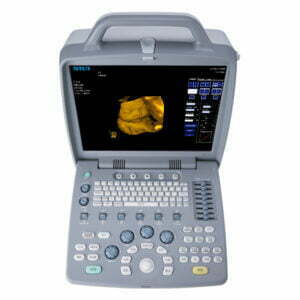 Ecograf B/W CTS-8800 Plus