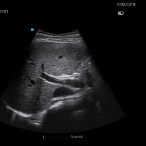 Ecograf Doppler color Apogee 1000 Lite