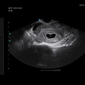 Ecograf Doppler color Apogee 5300