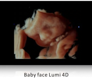 Ecograf Doppler color Apogee 5500