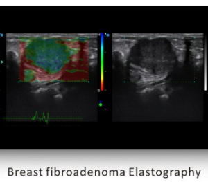 Ecograf Doppler color Apogee 5500
