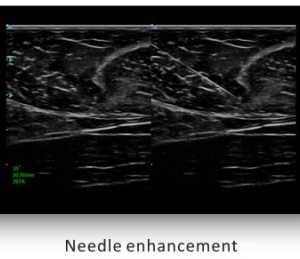 Ecograf Doppler color Apogee 5500