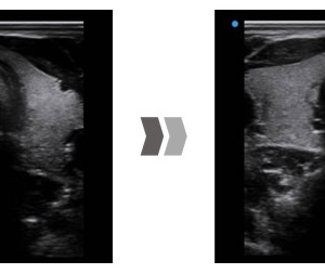 Ecograf Doppler color Apogee 5500