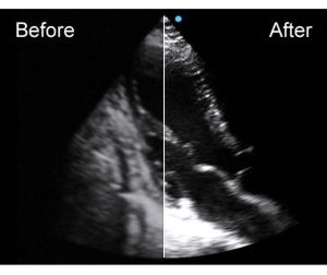 Ecograf Doppler color Apogee 5500