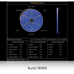 Ecograf Doppler color Apogee 5500