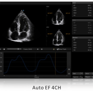 Ecograf Doppler color Apogee 5500