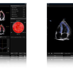 Ecograf Doppler color Apogee 5800