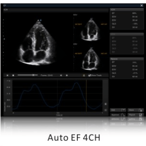 Ecograf Doppler color Apogee 5800