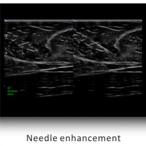 Ecograf Doppler color Apogee 5800