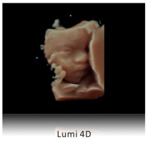 Ecograf Doppler color Apogee 5800