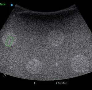 Ecograf Doppler color Apogee 5800 Genius