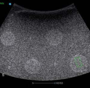 Ecograf Doppler color Apogee 5800 Genius