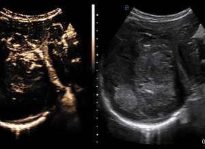 Ecograf Doppler color Apogee 5800 Genius