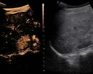 Ecograf Doppler color Apogee 5800 Genius