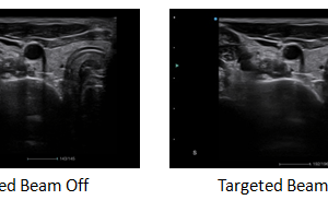 Ecograf Doppler color Apogee 5800 Genius