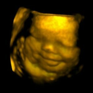 Ecograf Doppler color CTS-8800 Plus