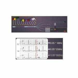 Electrocardiograf pediatric Zoncare IMAC 1500