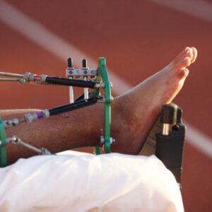 Lasere de mare putere - LUMIX C.P.S (Continuu, Pulsat si Superpulsat)