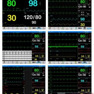 Monitor functii vitale Zoncare PM 7000D