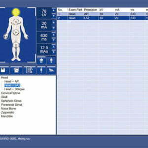 Sistem de scanare cu raze X SR-1000 Touch