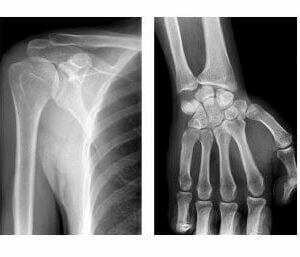 Sistem de scanare cu raze X SR-1000 Touch