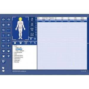 Sistem de scanare cu raze X SR-1000 Touch