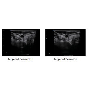 Ecograf Doppler color Apogee 5800 Genius