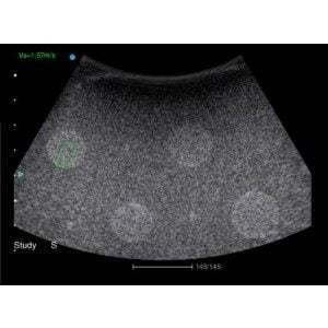 Ecograf Doppler color Apogee 5800 Genius