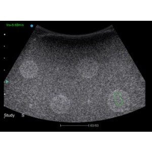 Ecograf Doppler color Apogee 5800 Genius