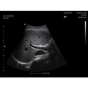 Ecograf Doppler color Apogee 1000 Lite