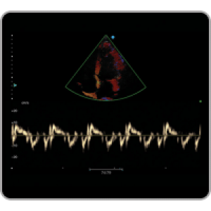 Ecograf Doppler color Apogee 1000 Neo