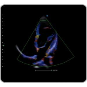Ecograf Doppler color Apogee 1000 Neo