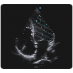 Ecograf Doppler color Apogee 1000 Neo