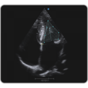 Ecograf Doppler color Apogee 1000 Neo