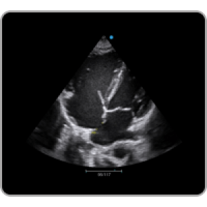 Ecograf Doppler color Apogee 1000 Neo