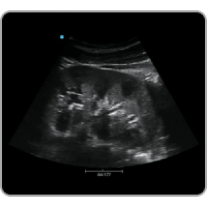 Ecograf Doppler color Apogee 1000 Neo