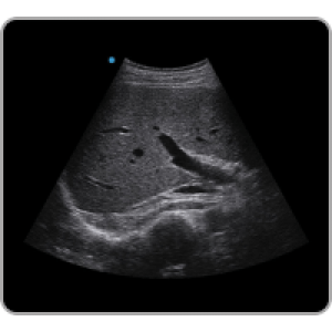 Ecograf Doppler color Apogee 1000 Neo