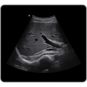 Ecograf Doppler color Apogee 1000 Neo
