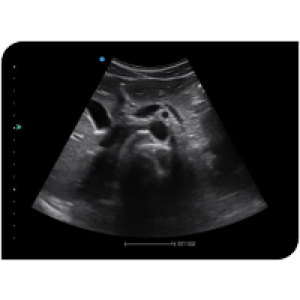 Ecograf Doppler color Apogee 2100 8 Ecograf Doppler color Apogee 2100