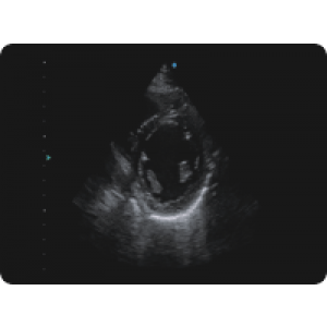 Ecograf Doppler color Apogee 5300