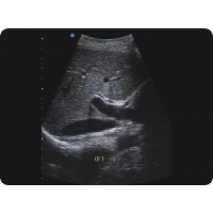 Ecograf Doppler color Apogee 5300