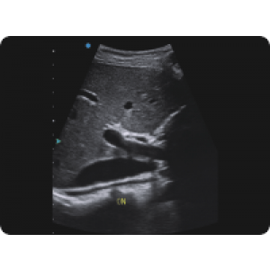 Ecograf Doppler color Apogee 5300