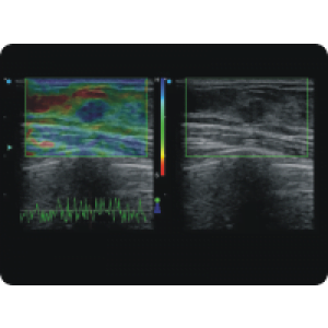 Ecograf Doppler color Apogee 5300