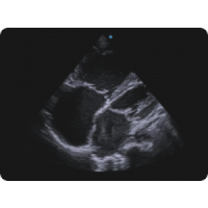 Ecograf Doppler color Apogee 5300