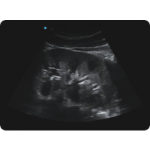 Ecograf Doppler color Apogee 5300