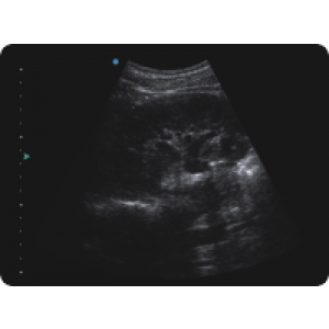 Ecograf Doppler color Apogee 5300