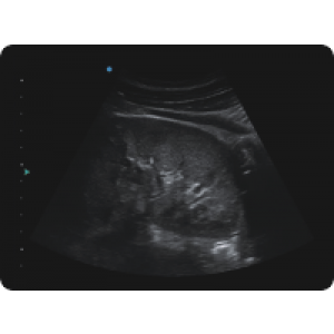 Ecograf Doppler color Apogee 5300