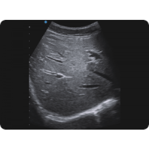 Ecograf Doppler color Apogee 5300