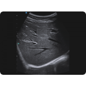 Ecograf Doppler color Apogee 5300